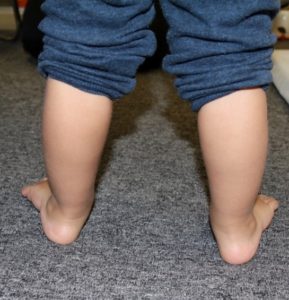 18 month old started walking clearance on toes