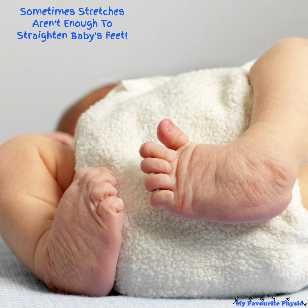 How to recognise if my baby's feet are normal or needs treatment